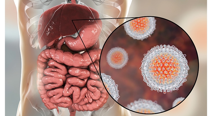 epatitis C virus infection medical concept, 3D illustration