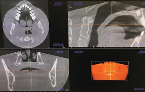 CBCT image slices