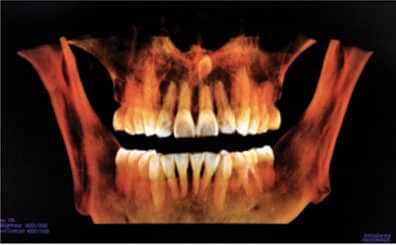 CBCT Imaging