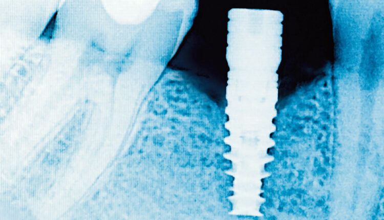 Endoscope