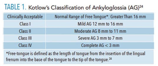 Classification of ankyloglossia