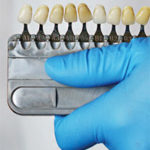 Tooth whitening