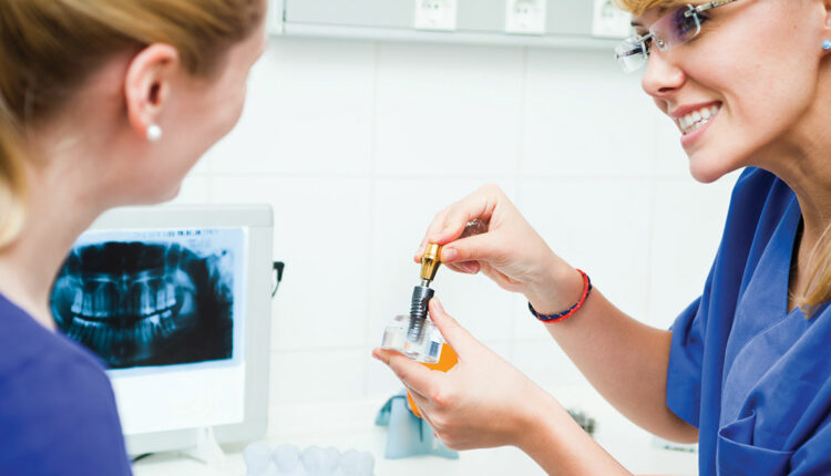 Clinicians with dental implant