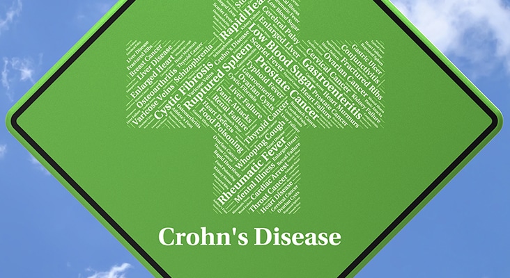 Crohn's Disease Represents Ill Health And Ileitis