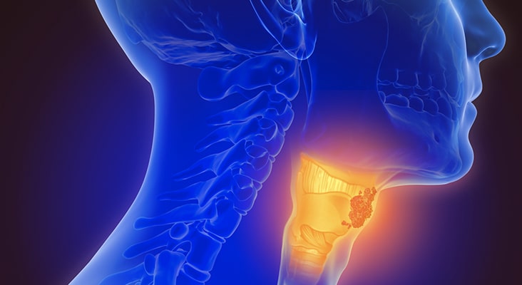 radiographic of throat