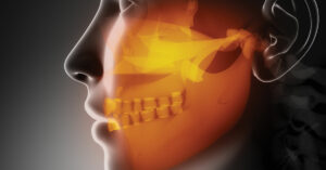 Temporomandibular disorders (TMDs)