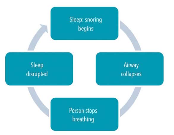 Tips for Treating Patients With Sleep Apnea