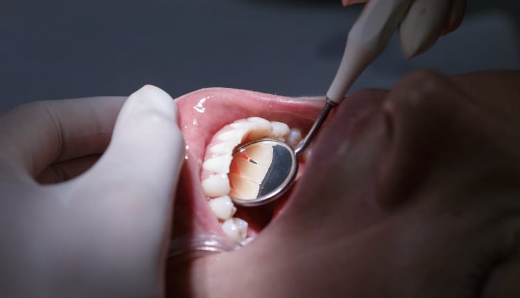 Patient getting her interdental spaces examined