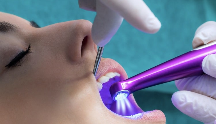 Dentist setting fissure sealant with led curing lamp on patient.