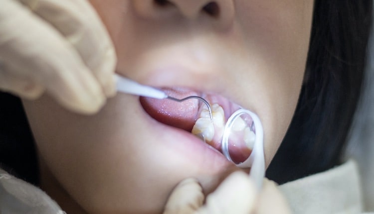 Dentist' hands using mirror and equipment check up teeth and cleaning for young Asia girl child with tooth sealant.