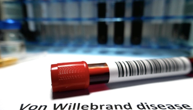 Von Willebrand blood clot disease