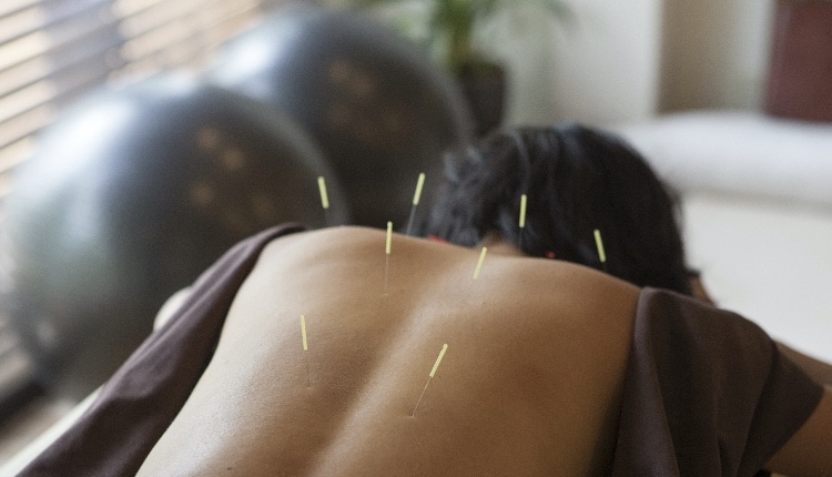 japanese female get acupuncture treatment in kyoto japan