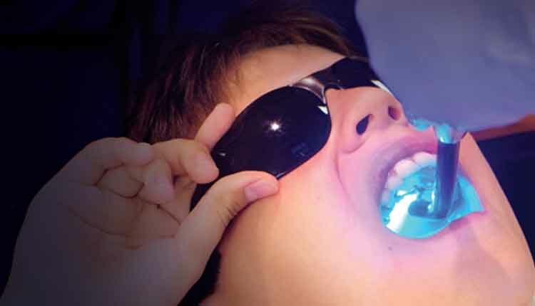 close up of child getting sealant done