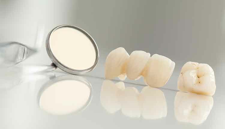 ceramic bridge