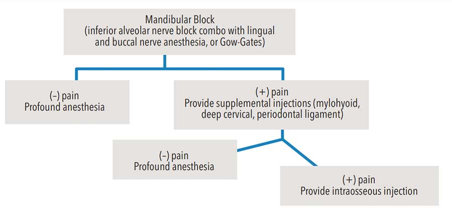  Injection algorithm for mandibular molars 