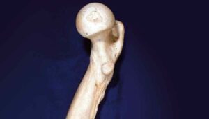 bone