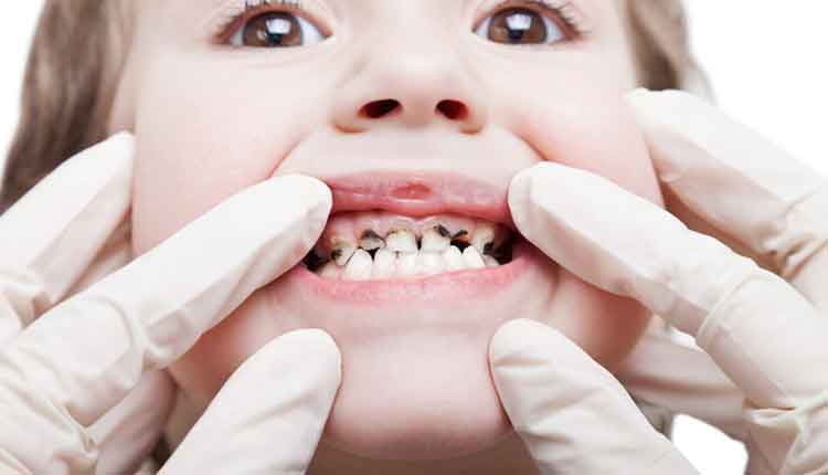 close up of child's teeth