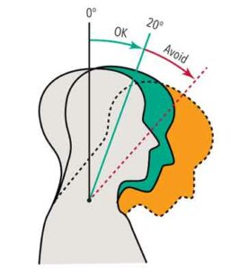 FIGURE 1.Head Tilt and Neck Flexion Range