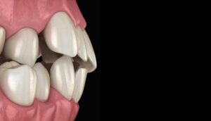 3d graphic of teeth