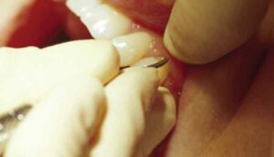 close up of dental exam