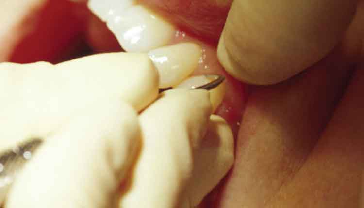 close up of dental exam