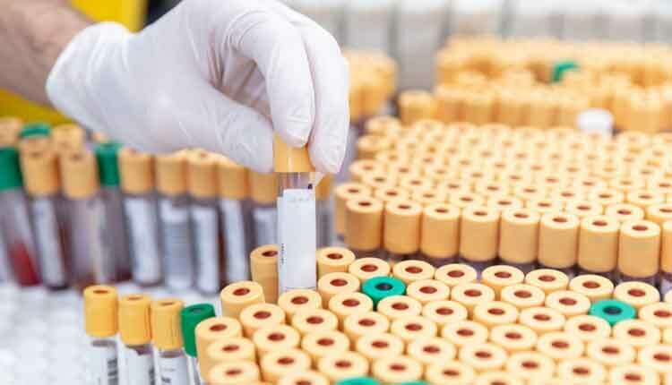 hand grabbing vial