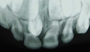 mouth xray