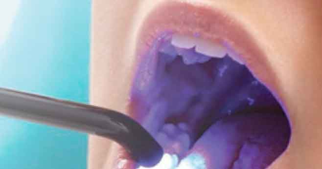 sealant