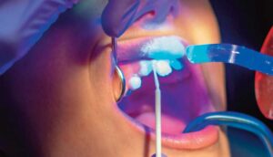 close up of dental exam