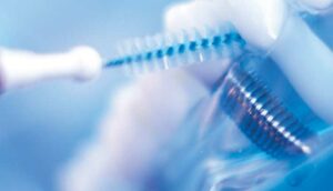 close up of dental implant cleaning
