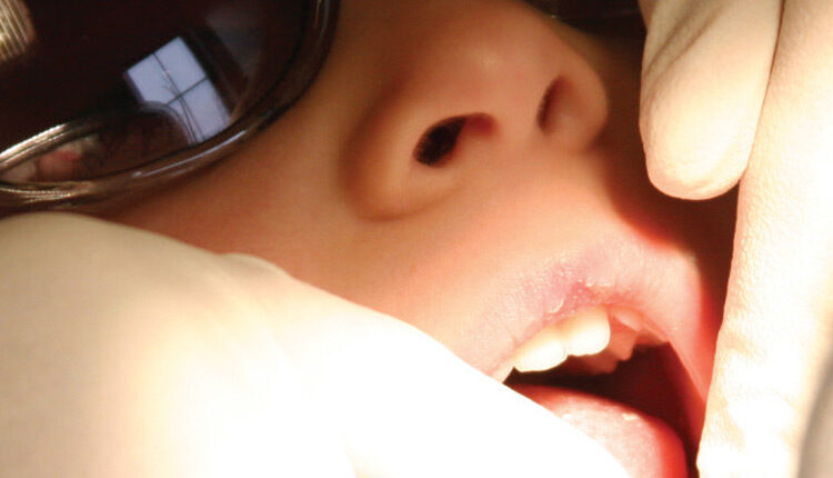 Young boy at dentist