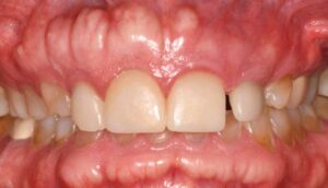 up close view of mouth