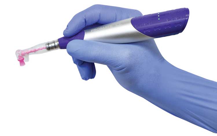 IGURE 1.Pac-Dent’s newest cordless handpiece model, ProMate CL, with the the AntiSplatr DPA.