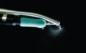 FIGURE 2. This photo shows the effect of a high-volume evacuator attached directly to an ultrasonic handle. The smaller contaminated particles are not visible in this photograph but if the larger/heavier particles are captured, it is highly likely that the smaller/lighter particles will also be captured.
