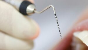 close up of dental tool during exam