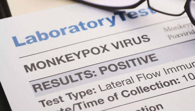 Monkeypox virus test results document