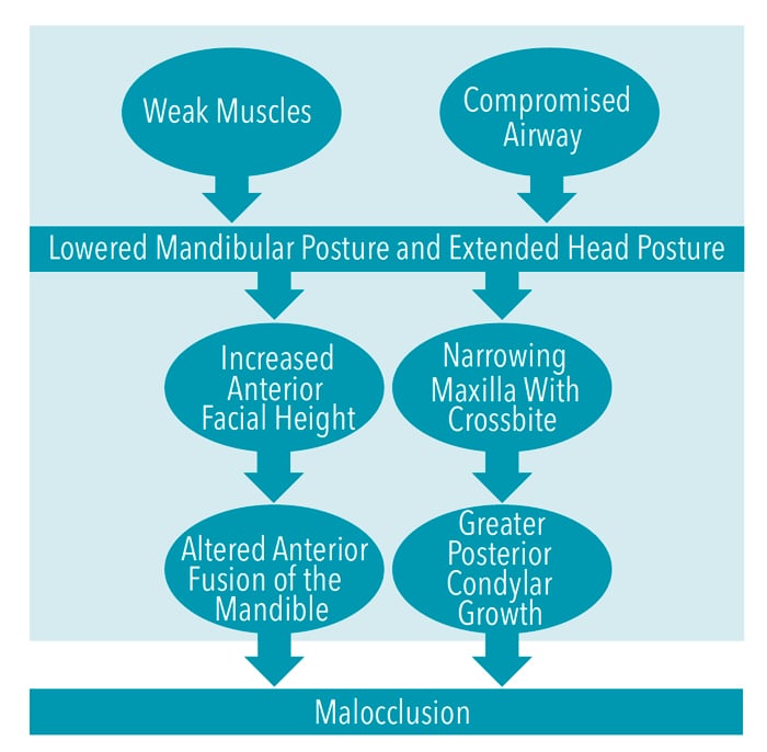 PDF] Evaluation of horizontal condylar angle in malocclusions with  mandibular lateral displacement using cone-beam computed tomography.