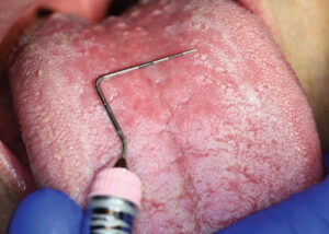 FIGURE 3. Reevaluation and surgical consultation in July 2021.