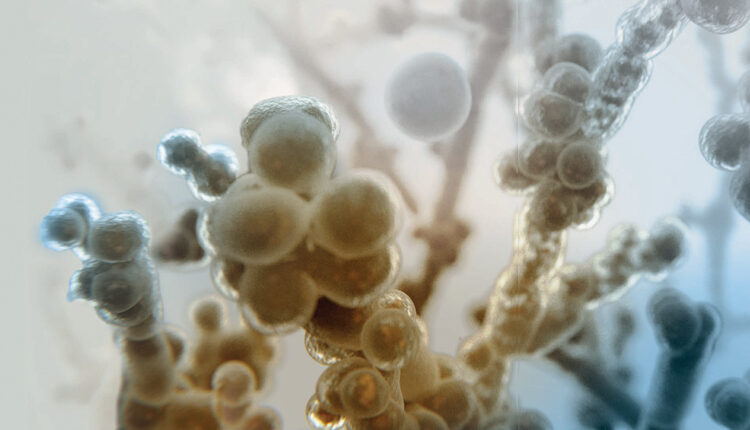 MULTIFOCAL CANDIDIASIS