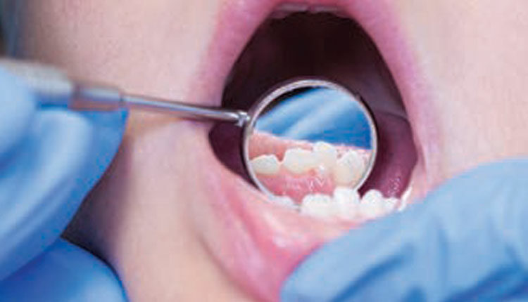 xerostomía caries y