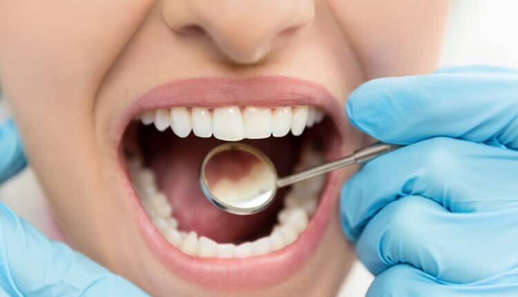 close up of mouth and dental tool