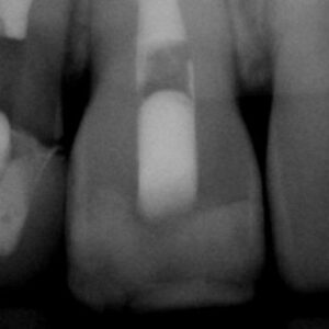mouth xrays