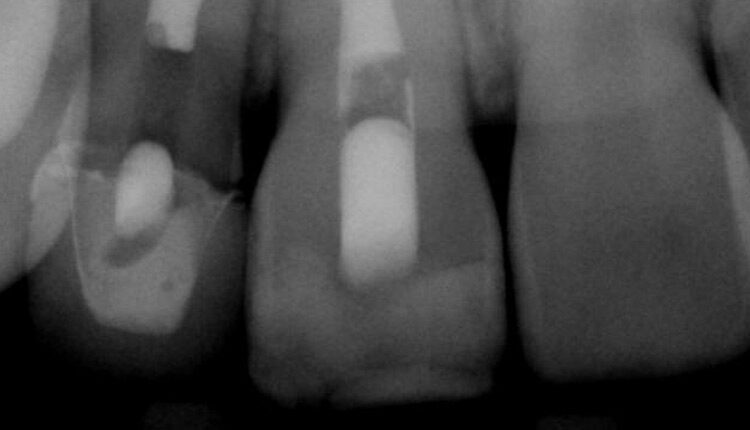 mouth xrays