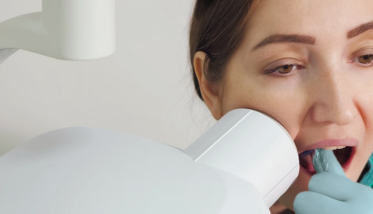 woman getting mouth xrays