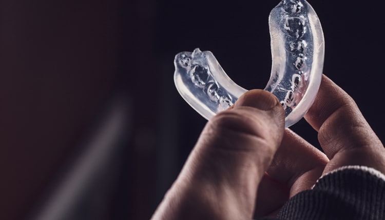 clear aligner