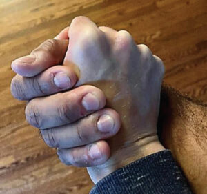 FIGURE 1. Hand-under-hand guidance may encourage cooperation among patients with Alzheimer disease.