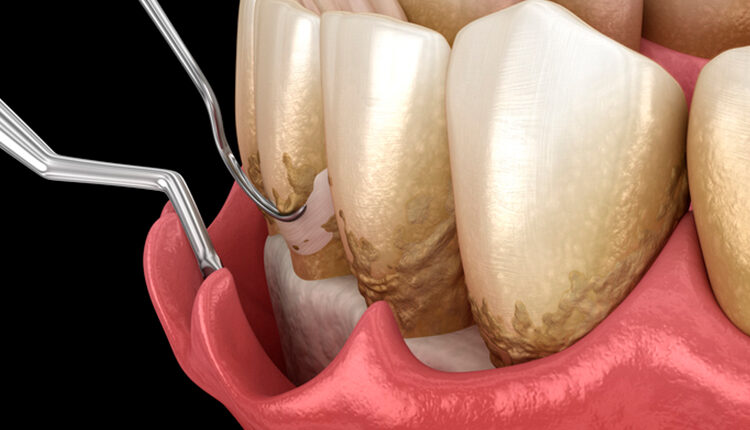 3d-mouth-rendering