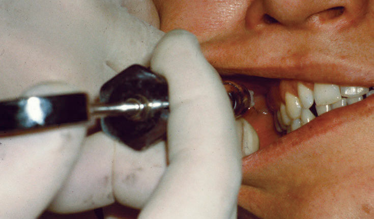 044_MandibularBlockCE_42-45-(Page-44)_Page_1_Image_0004