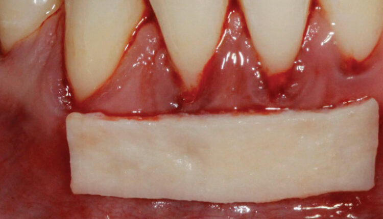 042_SoftTissueCE_42-45-(Page-42)_Page_1_Image_0002