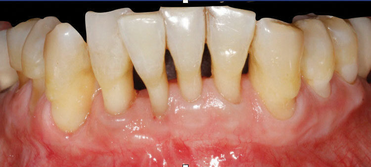 044_SoftTissueCE_42-45-(Page-44)_Page_1_Image_0005